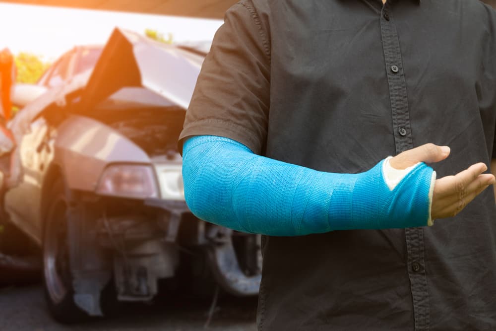 A man wear cloth arm splints to aid recovery from car accident injuries.