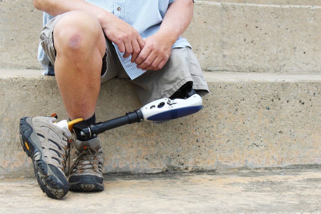 Man sitting on concrete steps with a prosthetic leg wearing hiking shoes. Man sitting on concrete steps with a prosthetic leg wearing hiking shoes.